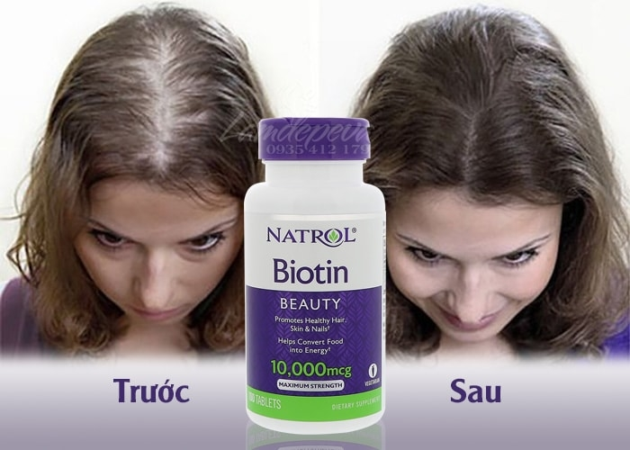 Thuốc mọc t&oacute;c Biotin của Mỹ&nbsp;