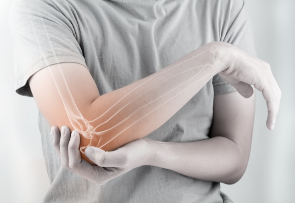 collagen gi&uacute;p giảm đau khớp