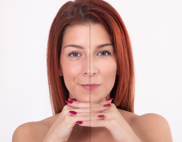 collagen 